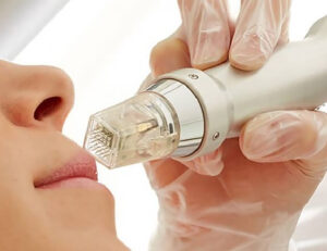 آر اف (RF) برای چه اهدافی به کار می رود؟