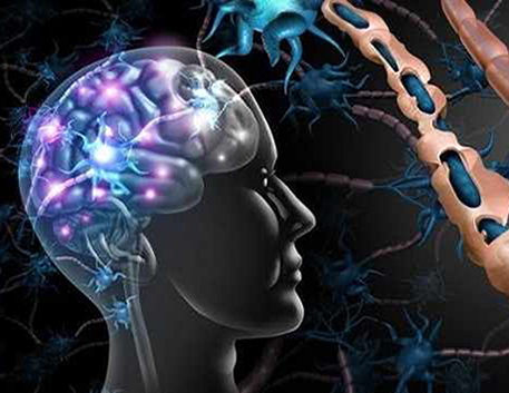 بیماری ام اس ( MS )