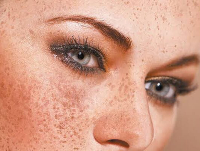 شایع ترین بیماری های پوستی