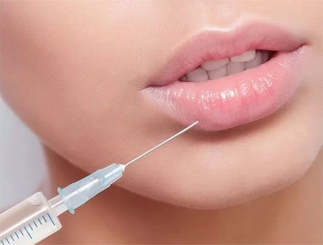 راهنمای کامل تزریق فیلر لب