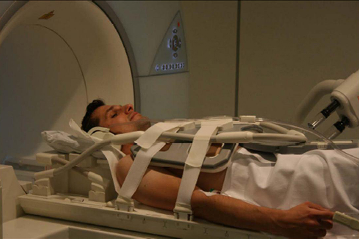MRI قلب