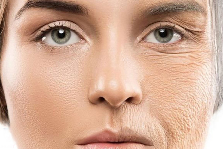 چین و چروک پوست