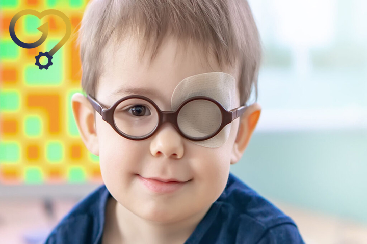 تنبلی چشم کودکان