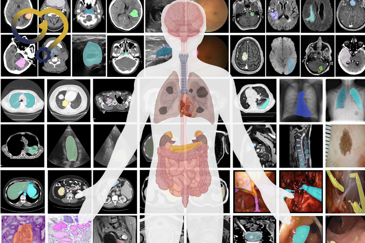انواع روش های تصویربرداری پزشکی