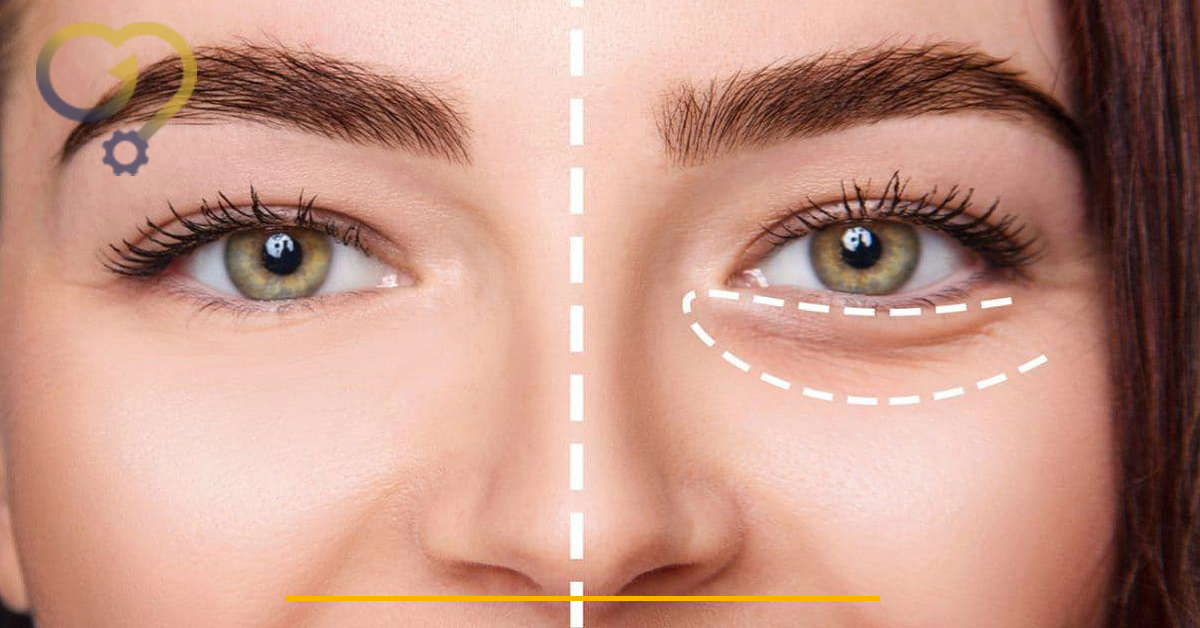 فواید کرم دور چشم