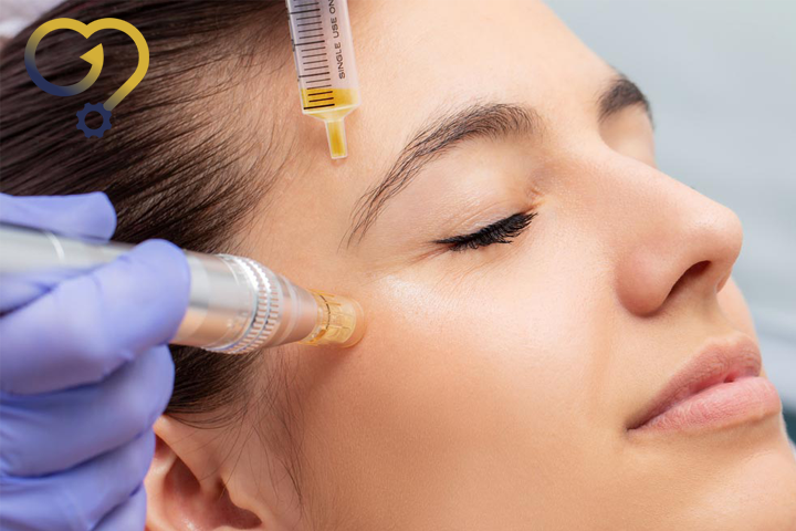 مزونیدلینگ