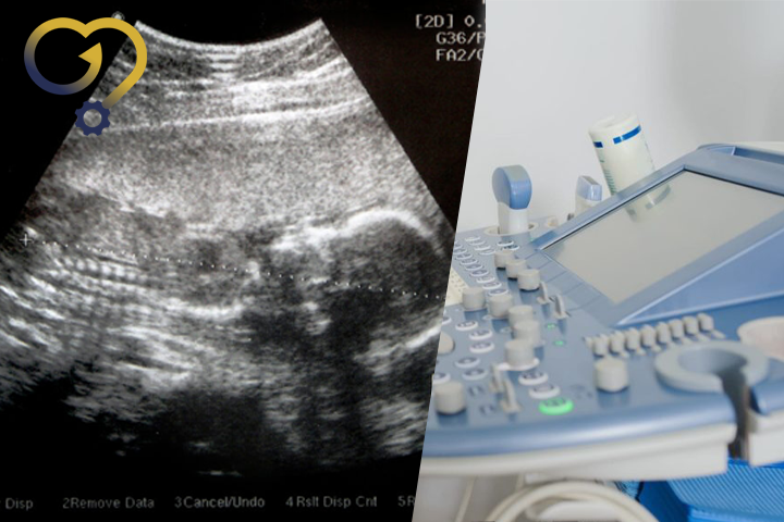 کاربرد سونوگرافی