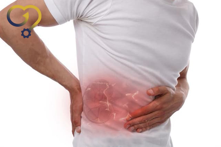 علائم سنگ کلیه